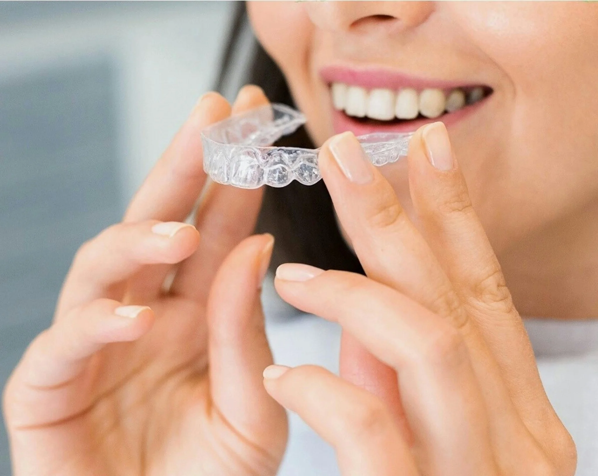 Invisalign clear aligners
