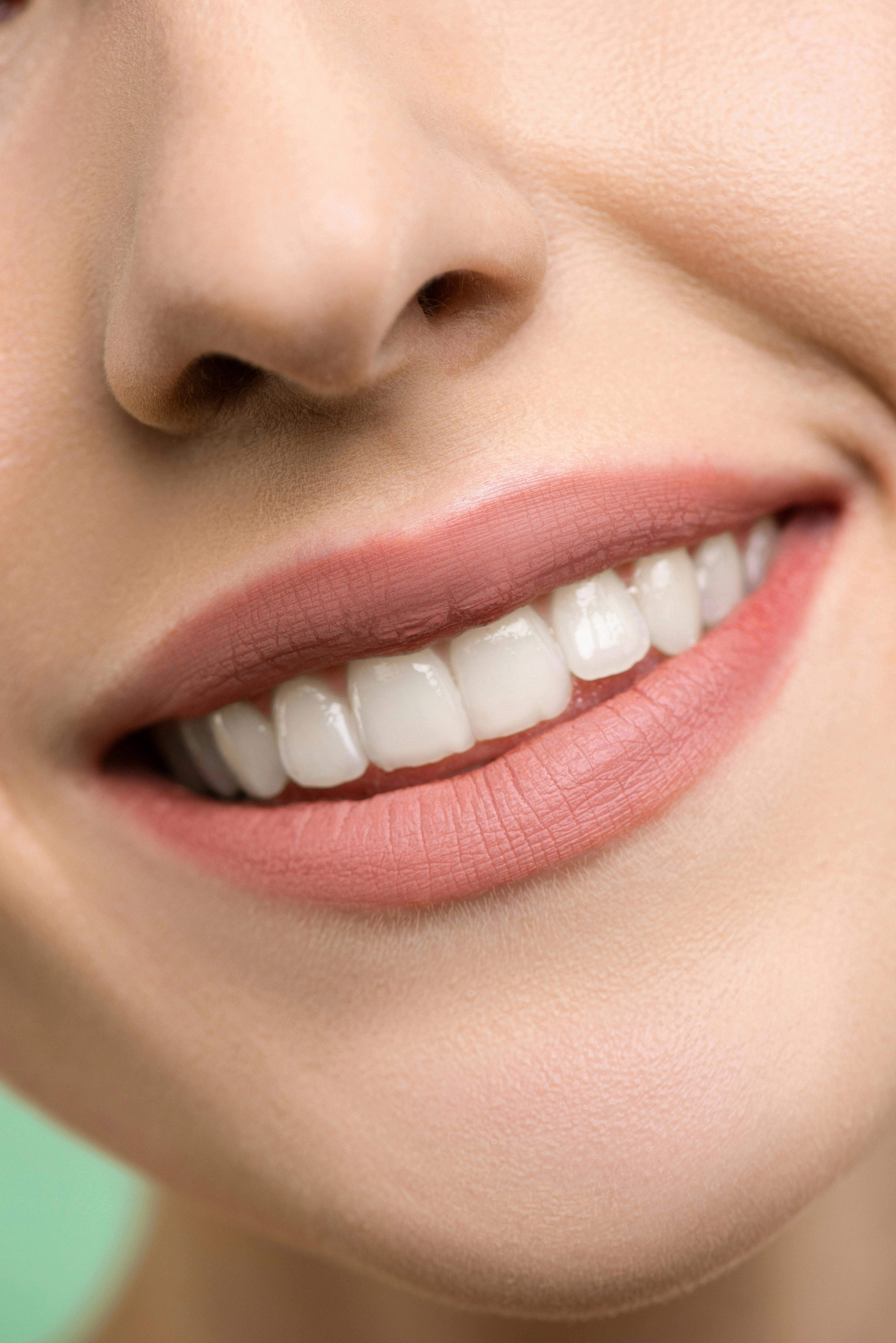 Professional teeth whitening treatment